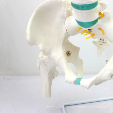 SPINE04-1 (12376) Medical Science Life Size Modelo vertebral da coluna vertebral com modelos de fêmur, espinha / vértebra